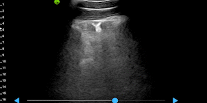 Porcine lard measurement